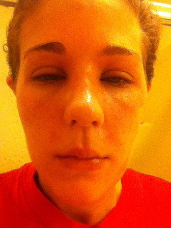 Allergies? What allergies?